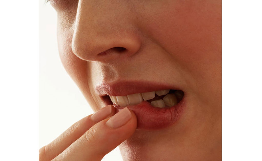Các khối u có thể xuất hiện trên bề mặt môi, trong khoang miệng